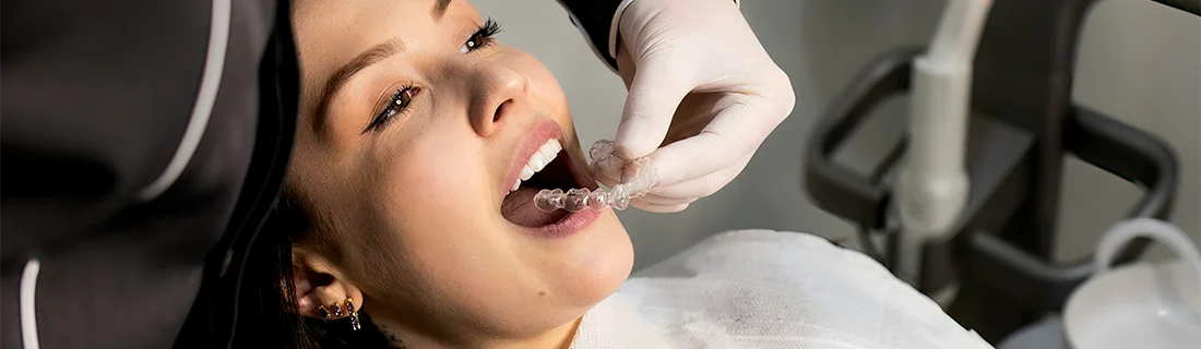 FC – Invisalign for Teens & Adults in Gallatin TN at Hunt Club Family Dental